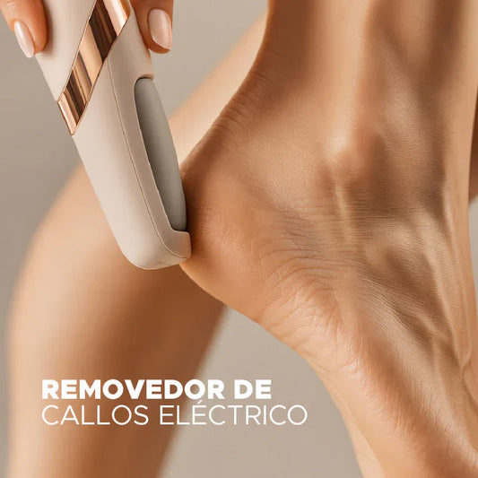 SoftFeet Pro - Removedor de Callos en Tendencia