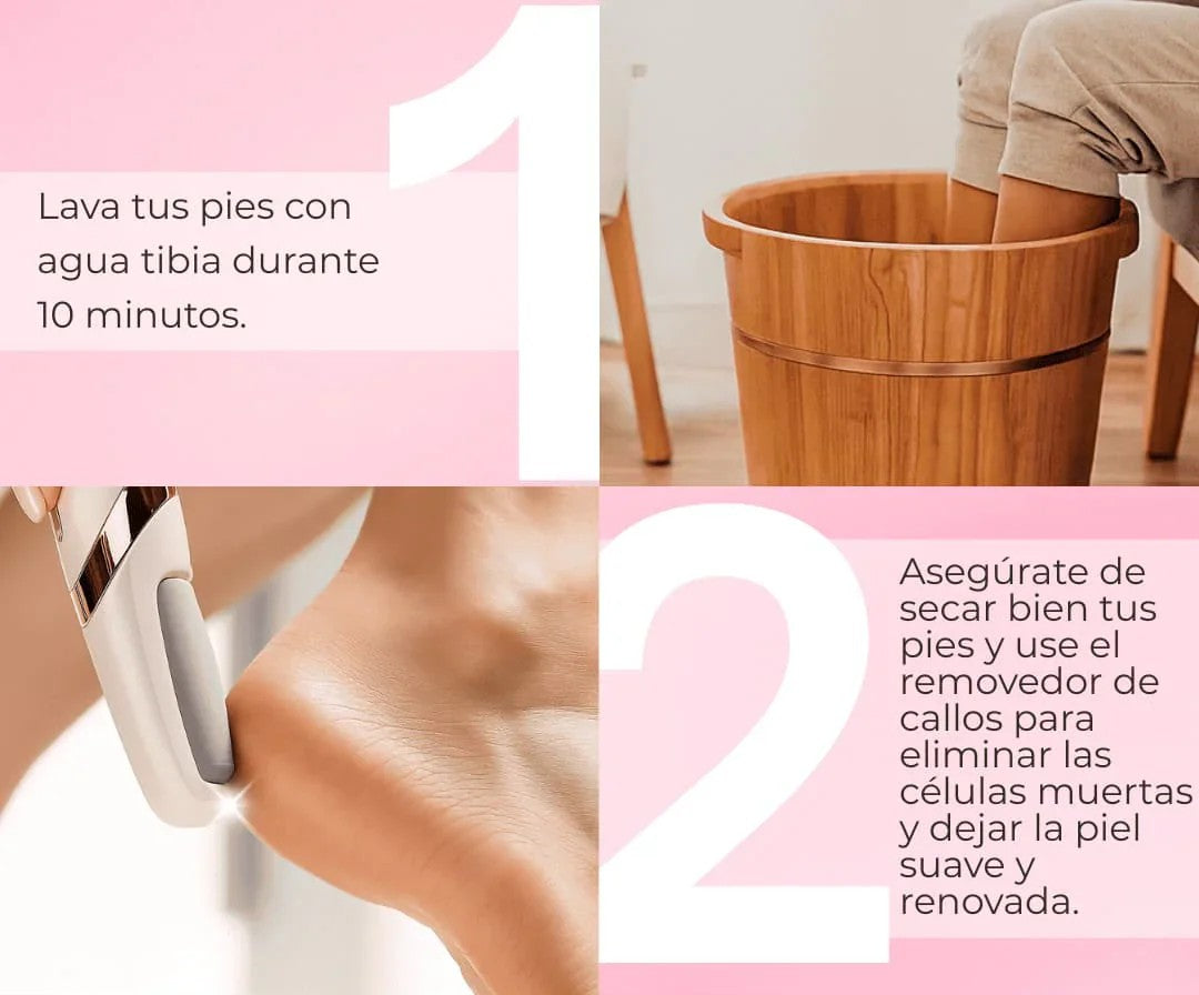SoftFeet Pro - Removedor de Callos en Tendencia