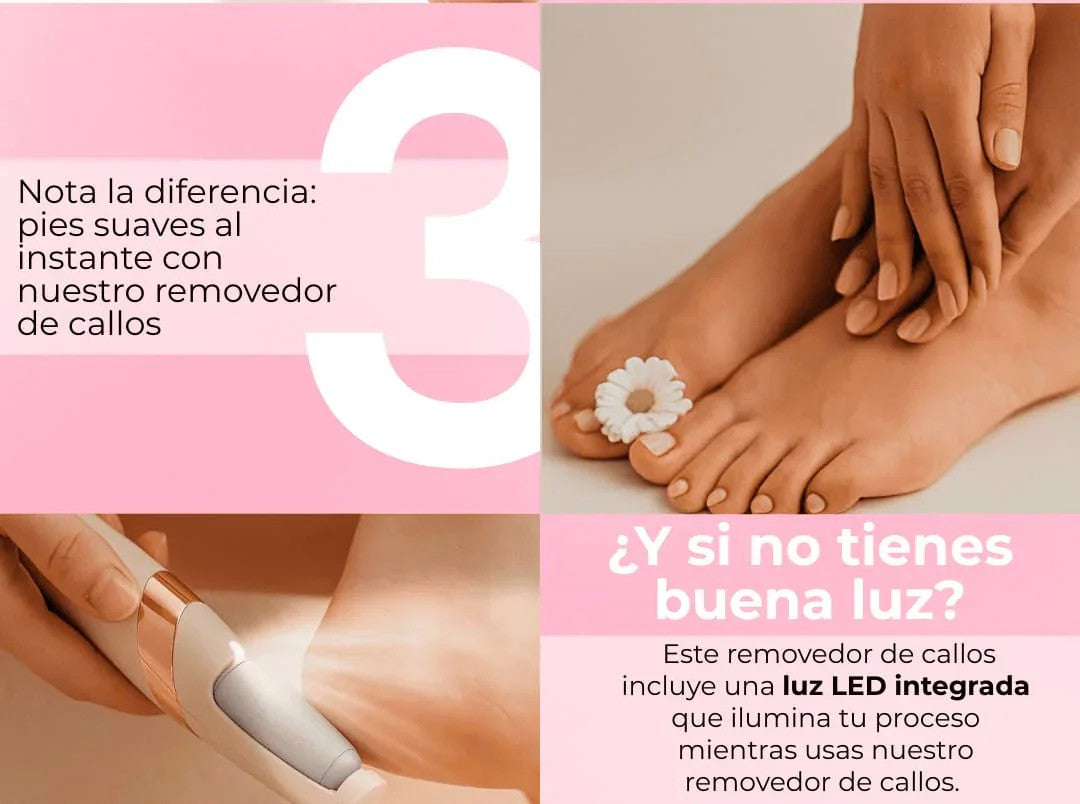 SoftFeet Pro - Removedor de Callos en Tendencia